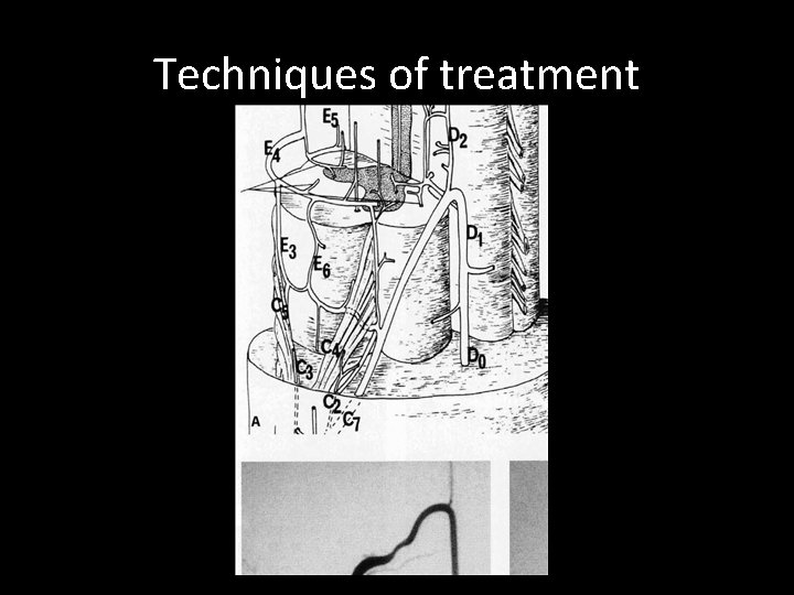 Techniques of treatment Techniques of treatment