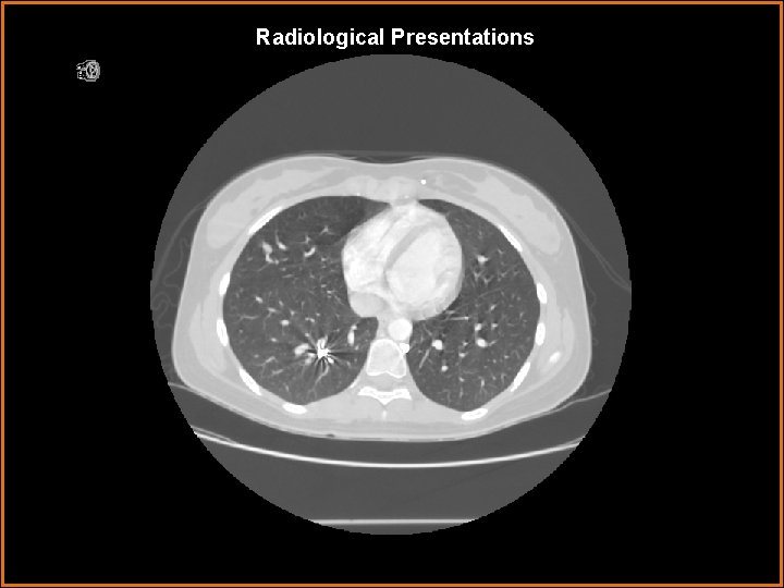 Radiological Presentations 