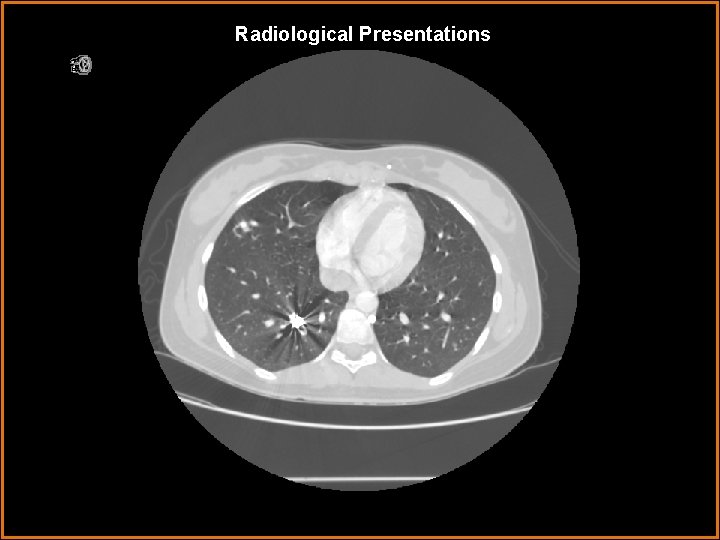 Radiological Presentations 