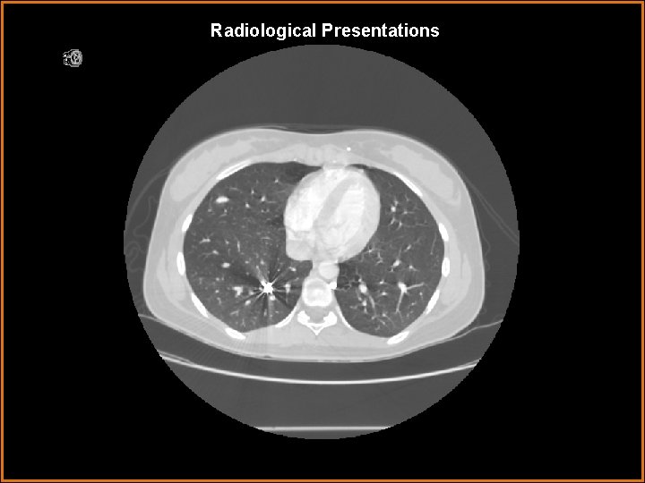 Radiological Presentations 