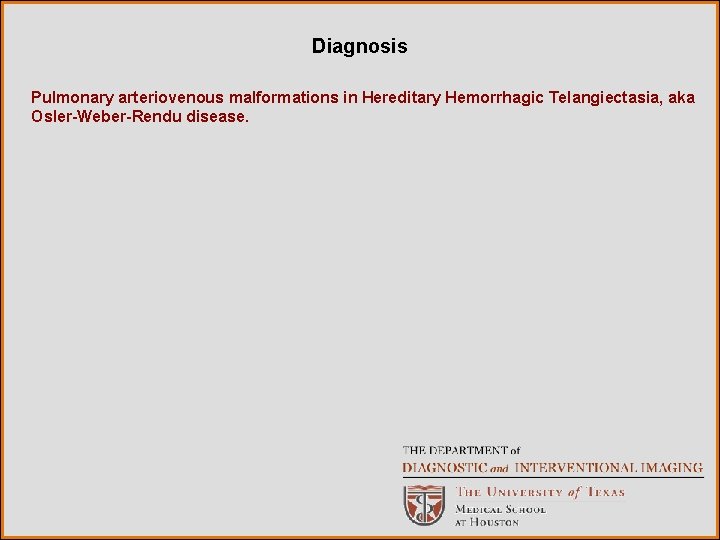 Diagnosis Pulmonary arteriovenous malformations in Hereditary Hemorrhagic Telangiectasia, aka Osler-Weber-Rendu disease. 