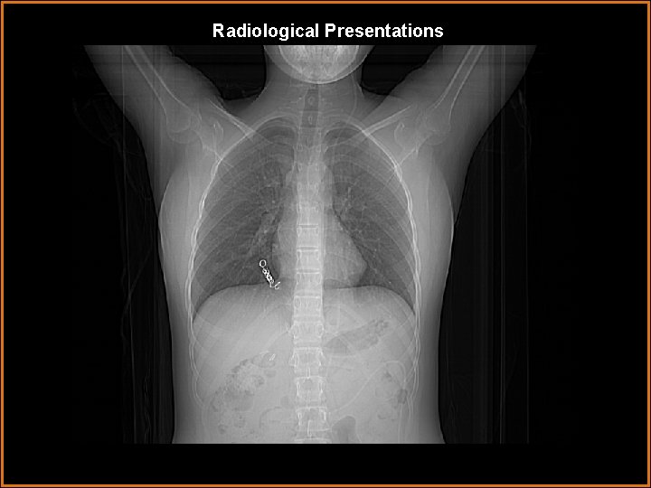 Radiological Presentations 