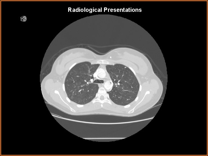 Radiological Presentations 