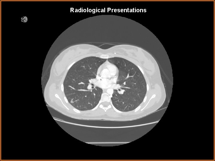 Radiological Presentations 