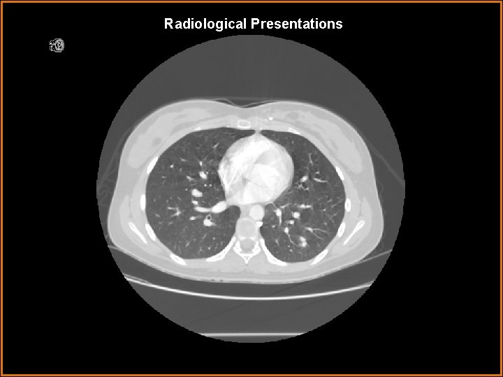 Radiological Presentations 