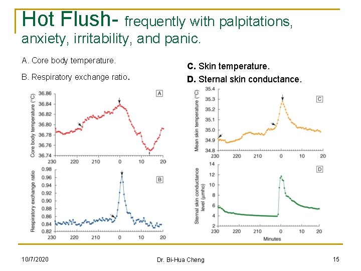 Hot Flush- frequently with palpitations, anxiety, irritability, and panic. A. Core body temperature. B.