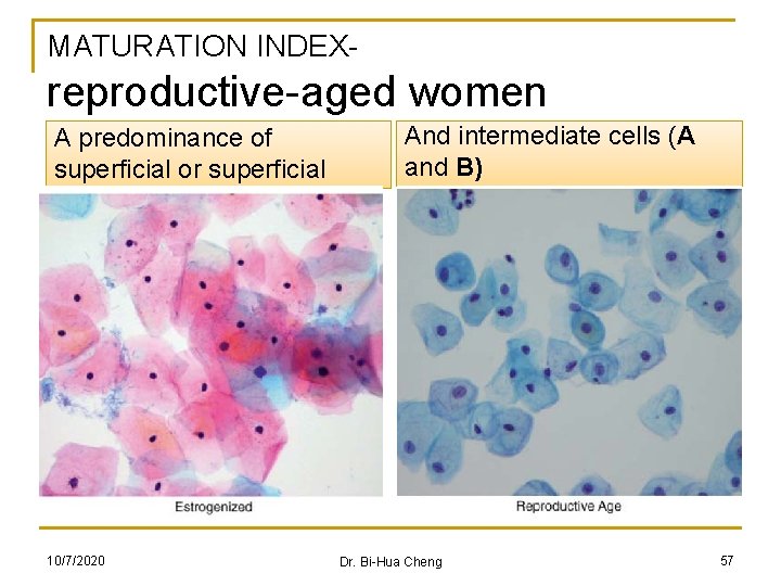 MATURATION INDEX- reproductive-aged women A predominance of superficial or superficial 10/7/2020 And intermediate cells