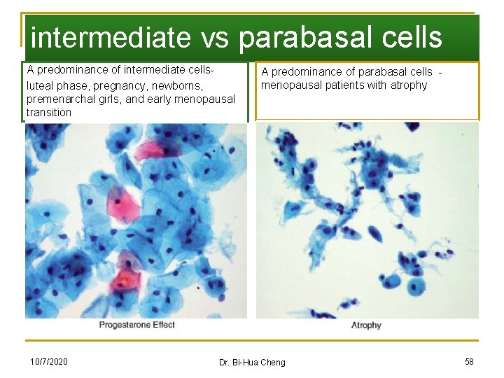 intermediate vs parabasal cells A predominance of intermediate cellsluteal phase, pregnancy, newborns, premenarchal girls,