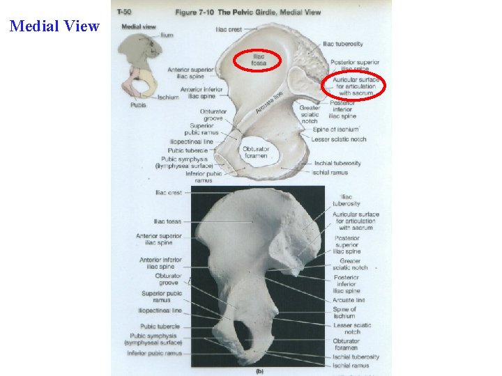 Medial View 