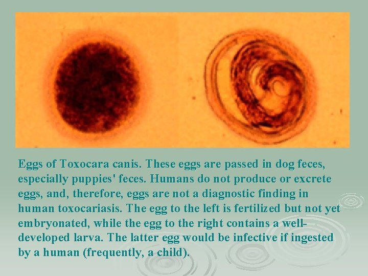 Eggs of Toxocara canis. These eggs are passed in dog feces, especially puppies' feces.