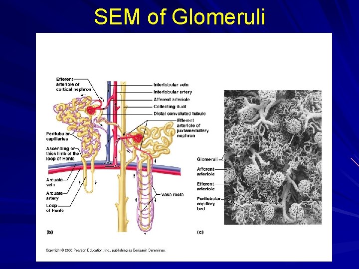 SEM of Glomeruli 