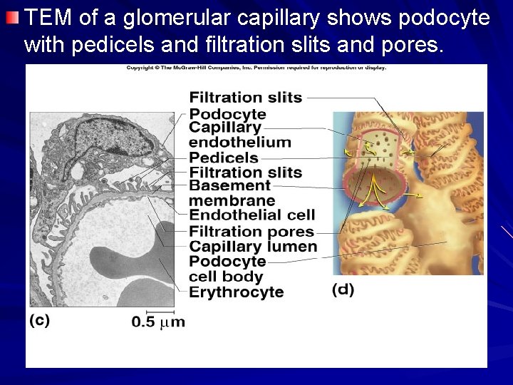 TEM of a glomerular capillary shows podocyte with pedicels and filtration slits and pores.