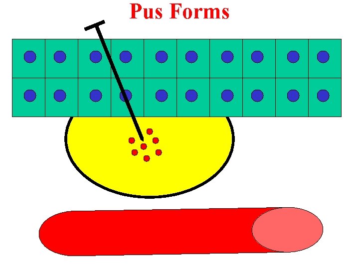 Pus Forms 