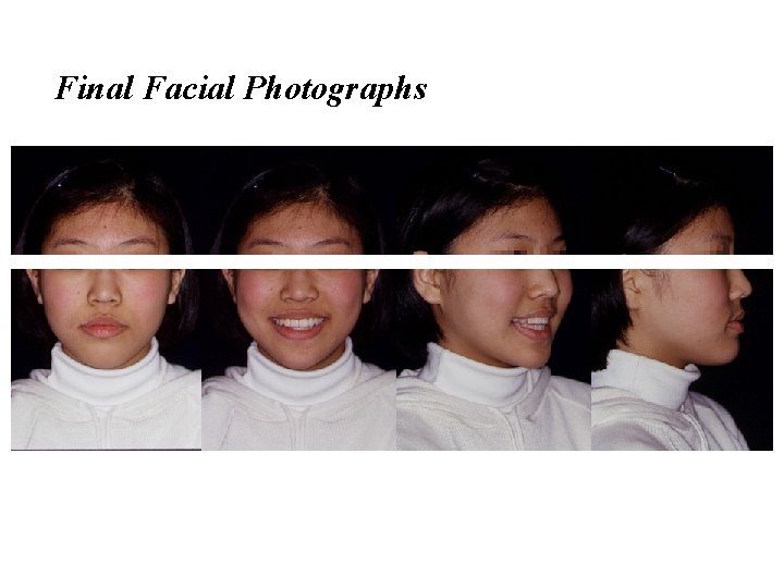 Final Facial Photographs 