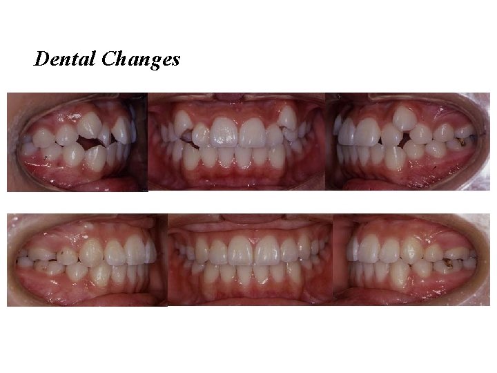 Dental Changes 