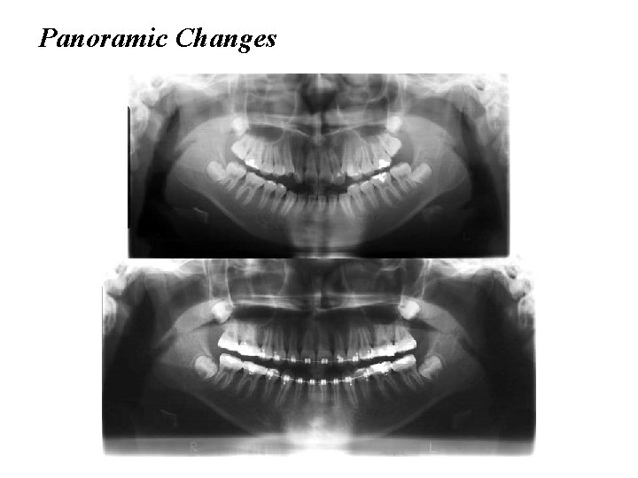 Panoramic Changes 