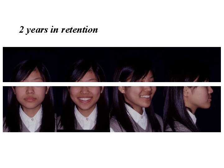 2 years in retention 