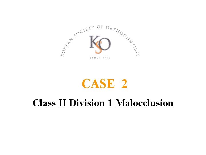 CASE 2 Class II Division 1 Malocclusion 