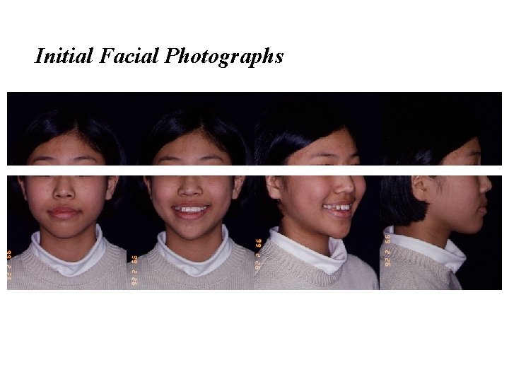 Initial Facial Photographs 