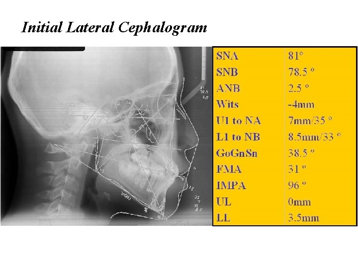 Initial Lateral Cephalogram 