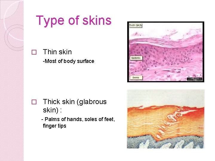 Type of skins � Thin skin -Most of body surface � Thick skin (glabrous