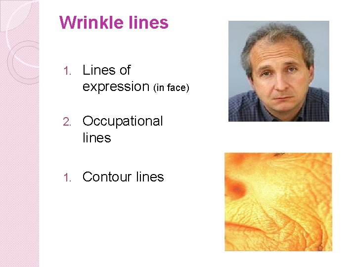 Wrinkle lines 1. Lines of expression (in face) 2. Occupational lines 1. Contour lines