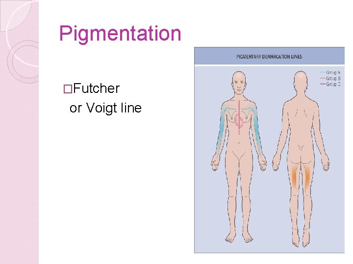 Pigmentation �Futcher or Voigt line 