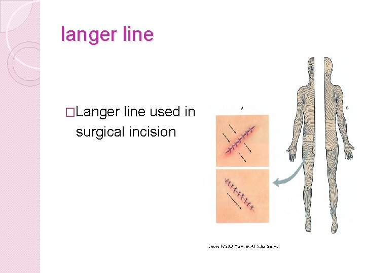 langer line �Langer line used in surgical incision 