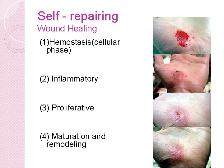 Self - repairing Wound Healing (1)Hemostasis(cellular phase) (2) Inflammatory (3) Proliferative (4) Maturation and