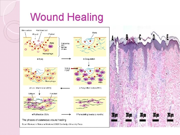 Wound Healing 