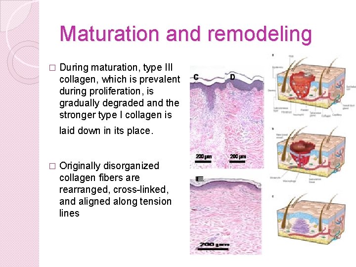 Maturation and remodeling � During maturation, type III collagen, which is prevalent during proliferation,