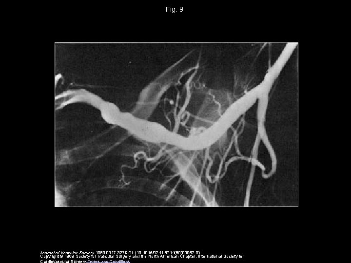 Fig. 9 Journal of Vascular Surgery 1989 9317 -327 DOI: (10. 1016/0741 -5214(89)90052 -9)