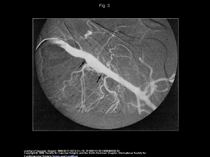 Fig. 3 Journal of Vascular Surgery 1989 9317 -327 DOI: (10. 1016/0741 -5214(89)90052 -9)