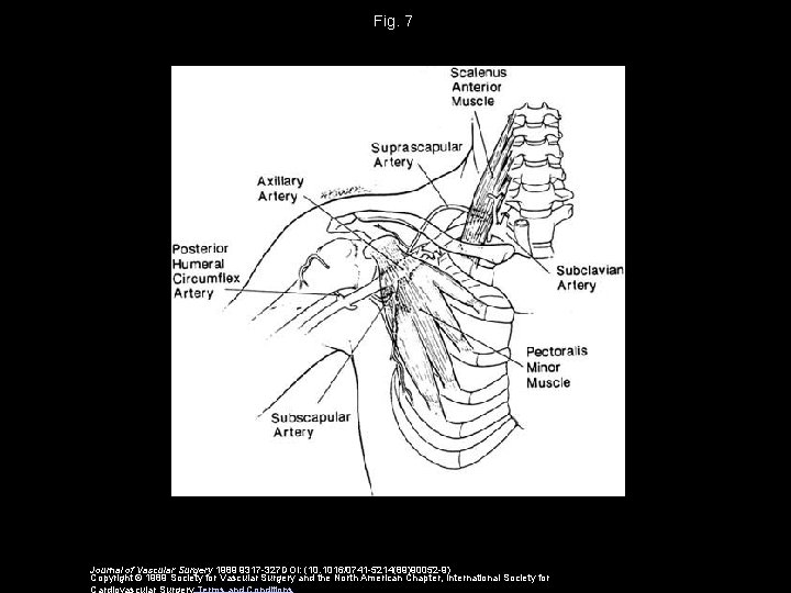 Fig. 7 Journal of Vascular Surgery 1989 9317 -327 DOI: (10. 1016/0741 -5214(89)90052 -9)