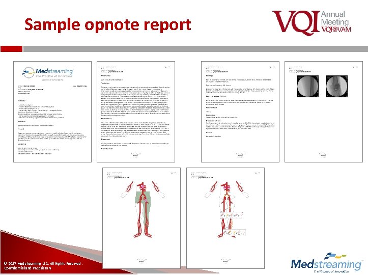 Sample opnote report © 2017 Medstreaming LLC. All Rights Reserved. Confidential and Proprietary 