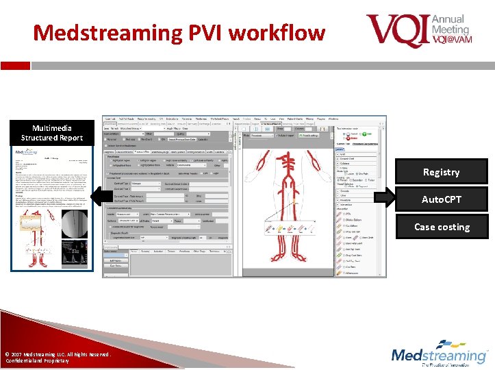 Medstreaming PVI workflow Multimedia Structured Report Registry Auto. CPT Case costing © 2017 Medstreaming