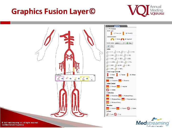 Graphics Fusion Layer© © 2017 Medstreaming LLC. All Rights Reserved. Confidential and Proprietary 