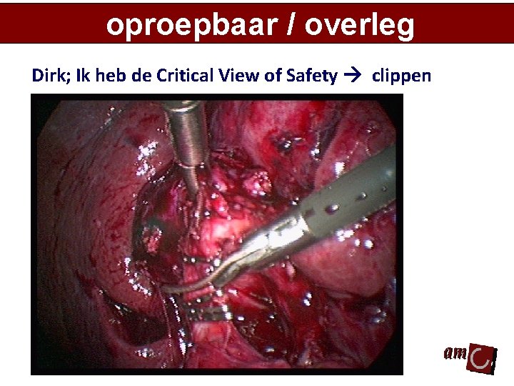 oproepbaar / overleg Dirk; Ik heb de Critical View of Safety clippen 