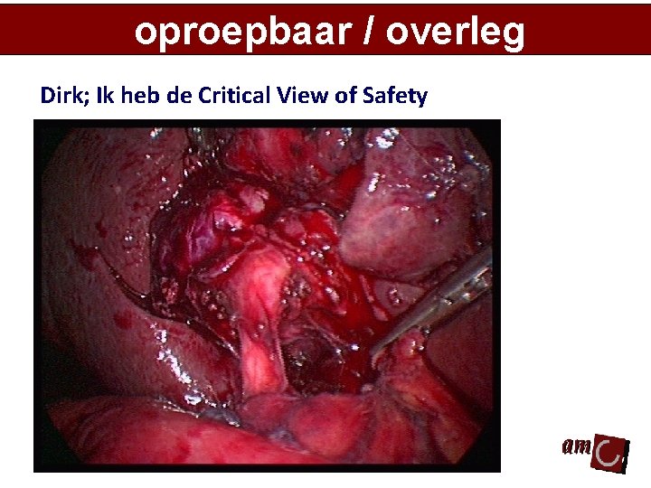 oproepbaar / overleg Dirk; Ik heb de Critical View of Safety 