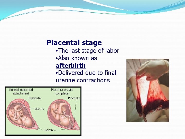 Placental stage • The last stage of labor • Also known as afterbirth •