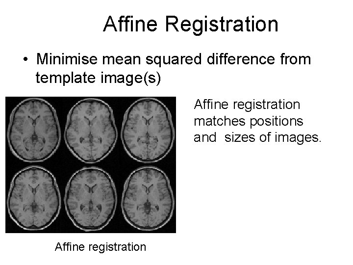 Affine Registration • Minimise mean squared difference from template image(s) Affine registration matches positions Affine Registration • Minimise mean squared difference from template image(s) Affine registration matches positions