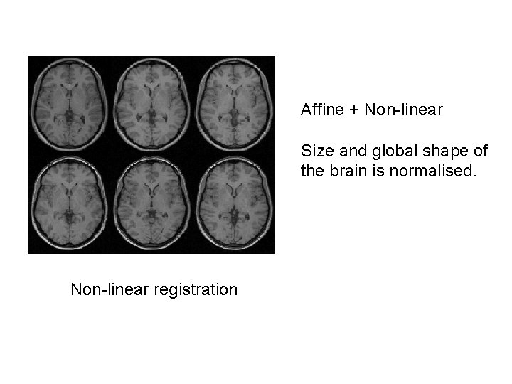 Affine + Non-linear Size and global shape of the brain is normalised. Non-linear registration Affine + Non-linear Size and global shape of the brain is normalised. Non-linear registration