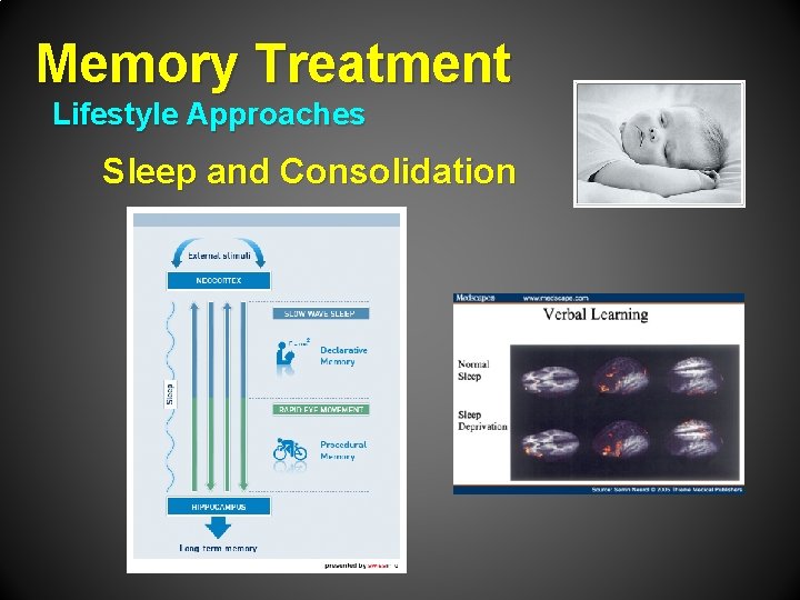 Memory Treatment Lifestyle Approaches Sleep and Consolidation 