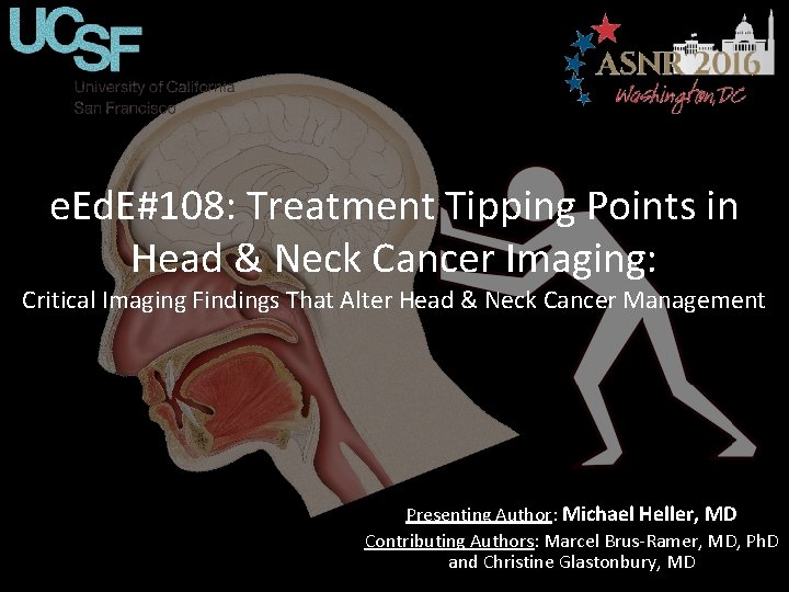 e. Ed. E#108: Treatment Tipping Points in Head & Neck Cancer Imaging: Critical Imaging e. Ed. E#108: Treatment Tipping Points in Head & Neck Cancer Imaging: Critical Imaging
