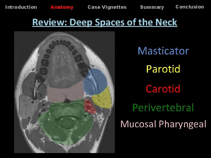 Introduction Anatomy Case Vignettes Summary Conclusion Review: Deep Spaces of the Neck Masticator Parotid Introduction Anatomy Case Vignettes Summary Conclusion Review: Deep Spaces of the Neck Masticator Parotid