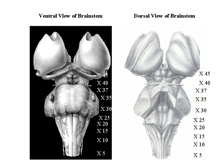 Ventral View of Brainstem X 45 X 40 X 37 X 35 X 30