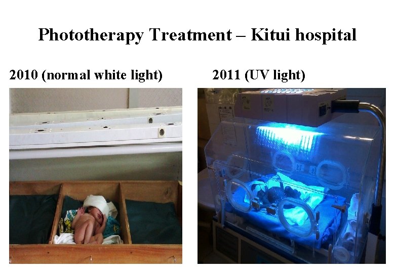 Phototherapy Treatment – Kitui hospital 2010 (normal white light) 2011 (UV light) 15 