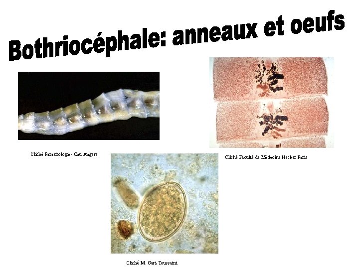 Cliché Parasitologie- Chu Angers Cliché Faculté de Médecine Necker Paris Cliché M. Gari-Toussaint 