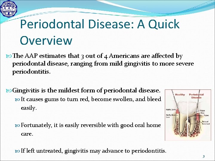 Periodontal Disease: A Quick Overview The AAP estimates that 3 out of 4 Americans