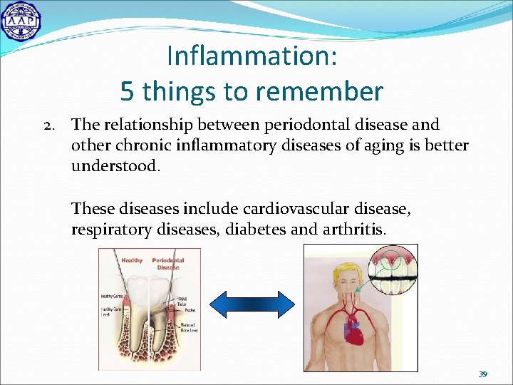 Inflammation: 5 things to remember 2. The relationship between periodontal disease and other chronic